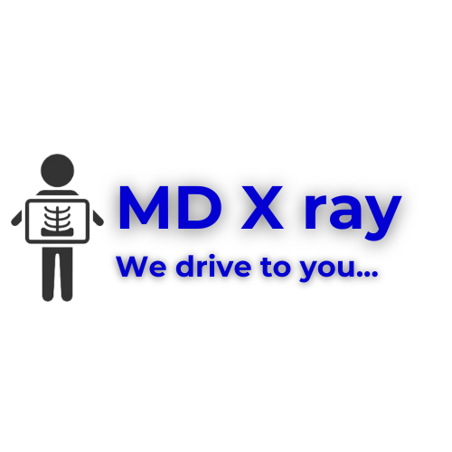Mobile Digital X-Ray