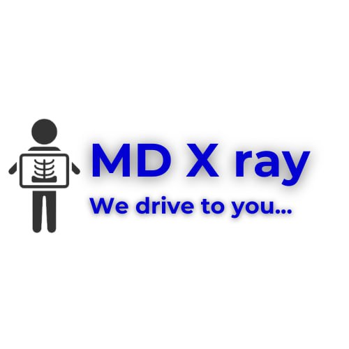 Mobile Digital X Ray